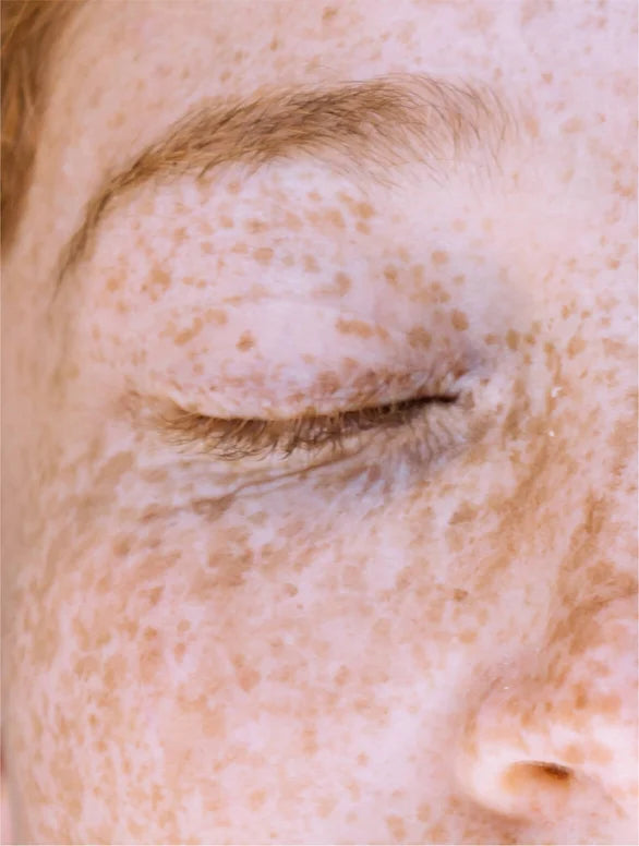 Crème Visage Anti-Taches à l'Acide Kojique
